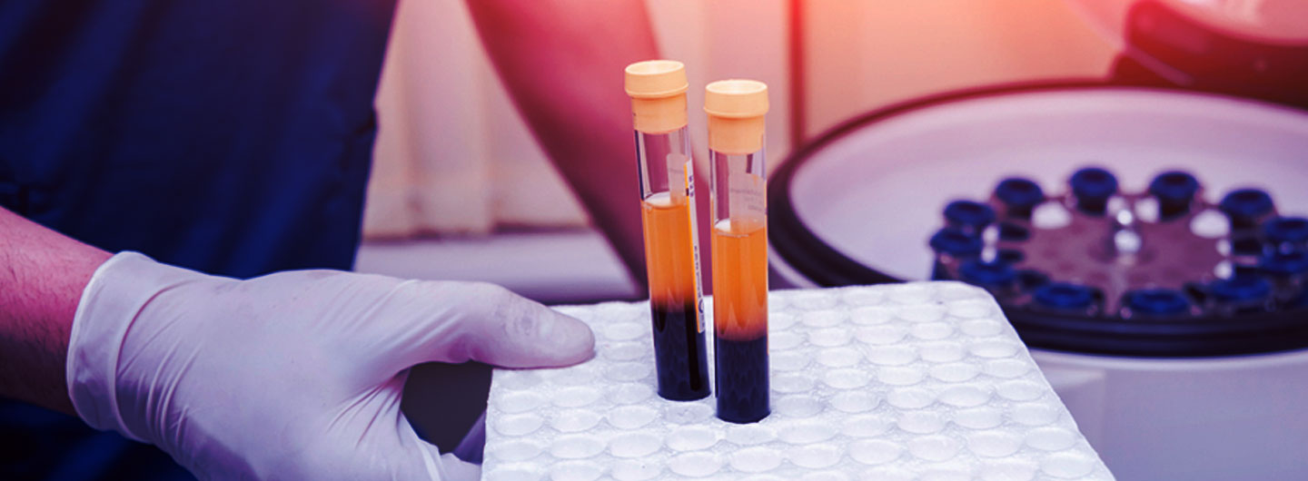 Regulatory aspects of Blood plasma therapy in Covid-19 scenario – Should we have woken up earlier?